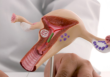 Intrauterine Insemination in Tambaram