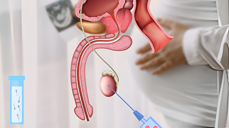 Best Pesa Treatment in Mudichur