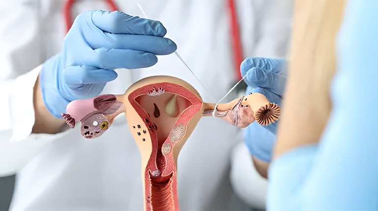 Best Gynecologist in Mudichur