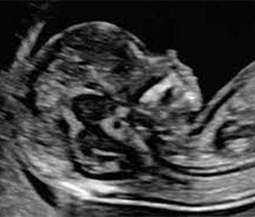 Best NT Scan Hospital in Mudichur
