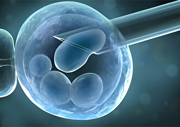 Best Sperm Retrieval Treatment in Tambaram